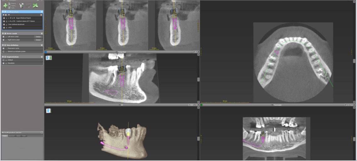 One Stop Dental 3D CT Scan Inner Page