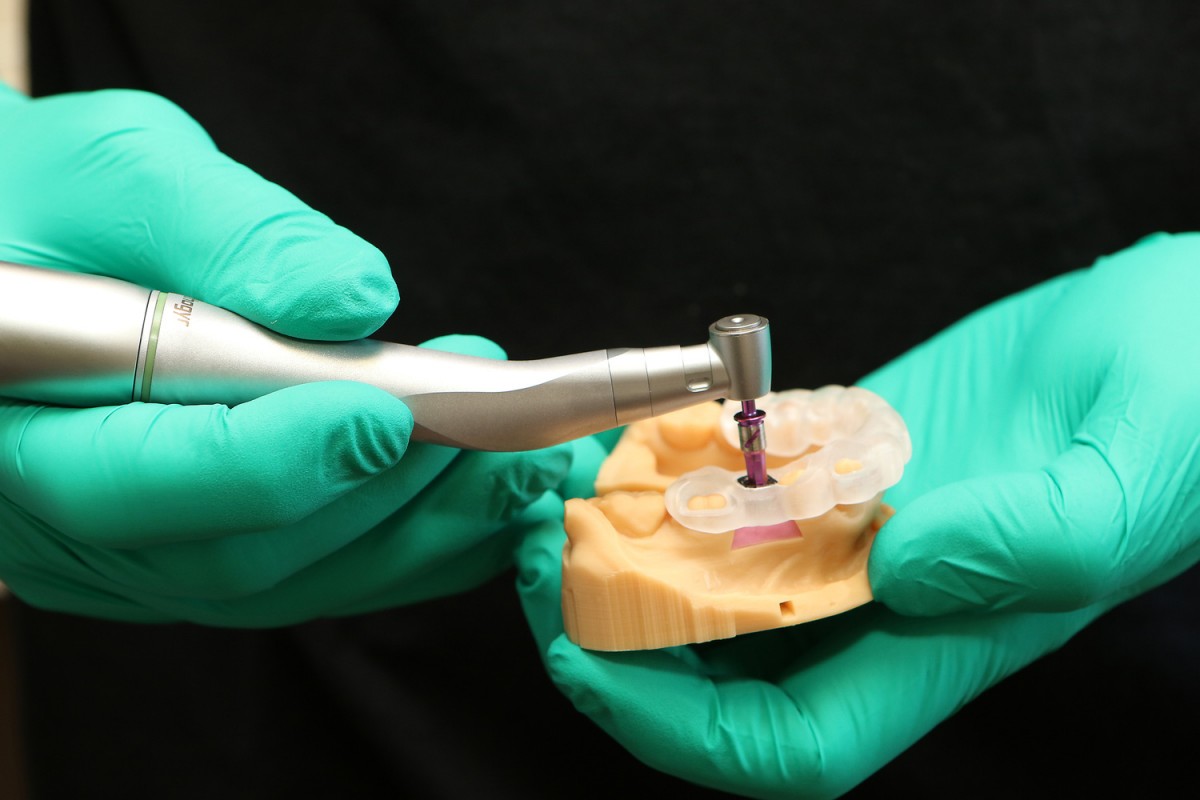 Quality SingleTooth Dental Implants in Colorado Springs