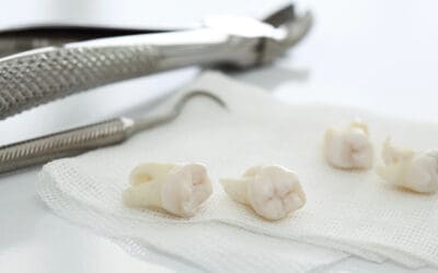 Dental crown procedure for front teeth: How it works and what it looks like