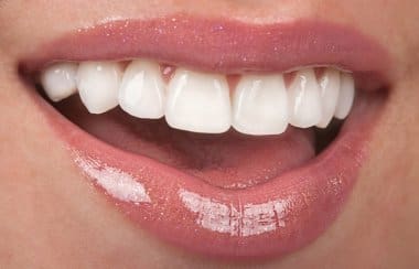 Cosmetic Dentistry Near Me: Enhance Your Smile with Local Experts